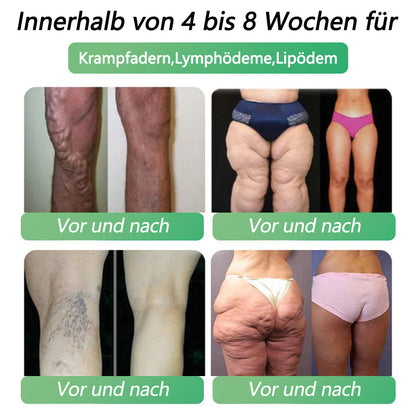 Offizieller Shop | 𝐂𝐯𝐫𝐞𝐨𝐳® GLP-1 Sechs-in-Eins Gesundheitslösung Orale Flüssigkeit (Nur einmal täglich, sichtbare Veränderungen nach 7 Tagen) Für Fettleibigkeit, Herz-Kreislauf-Gesundheit, Diabetes, Schlafapnoe, Darmgesundheit, Gelenkbeschwerden und mehr.